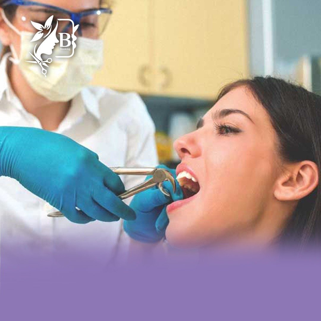 خلع ضرس العقل المنظمر جزئياً