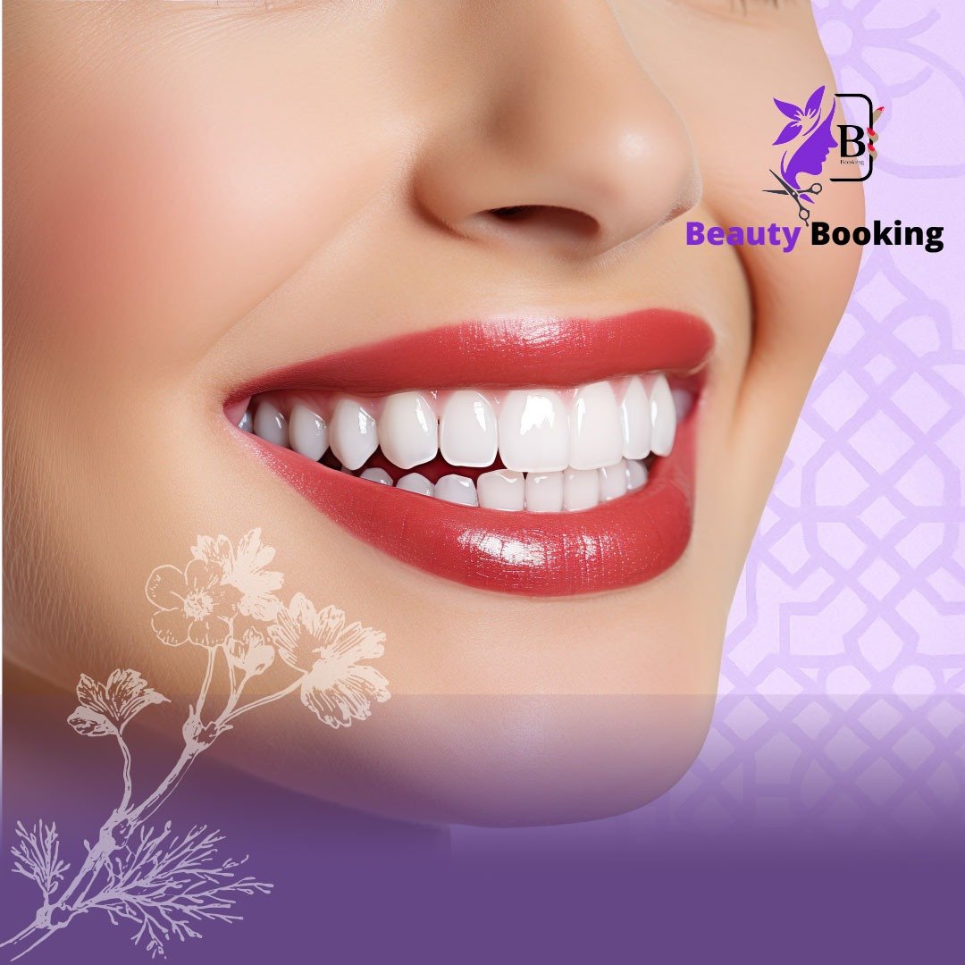 تبييض منزلي